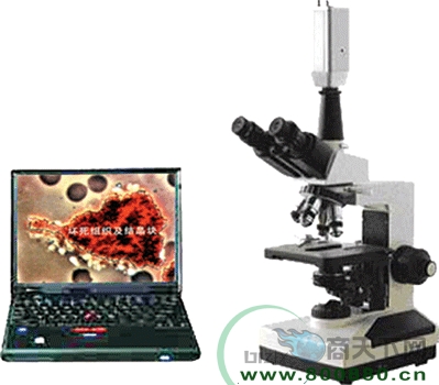 �߲�һ��Ѫ�z�y(c��)�x